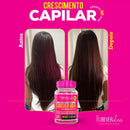 Vitamina Forever Hair 1 Meses Tratamento Crescimento Capilar