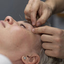 Agulha De Acupuntura 0,25x30 Sistêmica Caixa Com 1000 Un