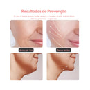 Aparelho Tratamento Facial Led Terapia 3 Cores B Basto Lift Fototerapia Massageador Rosto Estética