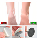 Broca De Unha Disco Para Remoção E Polimento +10 Refil Disco