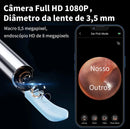 Limpador de cera ouvido pinças lanterna seringa preto Kit 9 em 1 câmera otoscópio