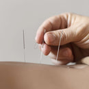 Agulha De Acupuntura 0,25x30 Sistêmica Caixa Com 1000 Un