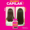 Vitamina Forever Hair 1 Meses Tratamento Crescimento Capilar