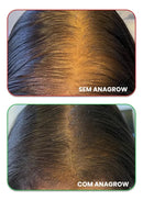 Vitamina Contra Afinamento Capilar Osa - 30 Cápsulas Sem Sabor