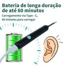 Limpador de cera ouvido pinças lanterna seringa preto Kit 9 em 1 câmera otoscópio