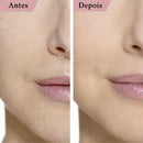 Kit 6 Navalhas para Sobrancelha e Rosto – Lâminas em Aço Inoxidável com Cabo Antiderrapante, Precisão para Depilação Facial, Buço e Corpo